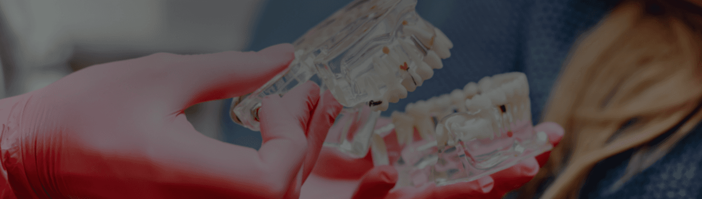 Dental Implants Hero